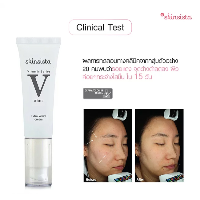 Skinsista V Extra White Facial Cream 