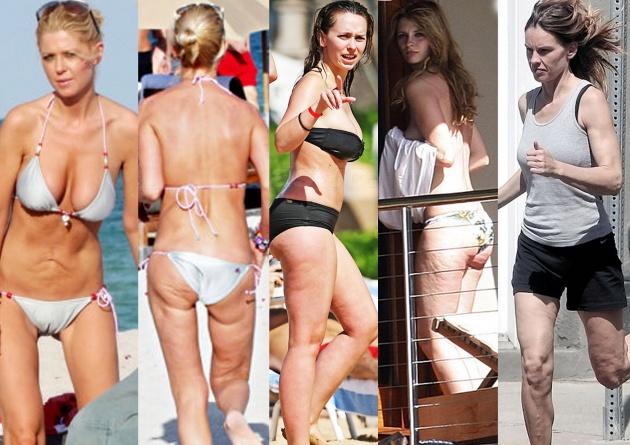 เซเลบริตี้ก็ต้องมีปัญหากับเซลลูไลท์